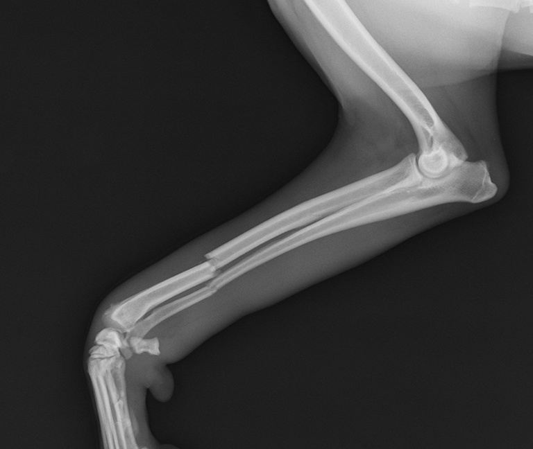 Chirurgies orthopédiques